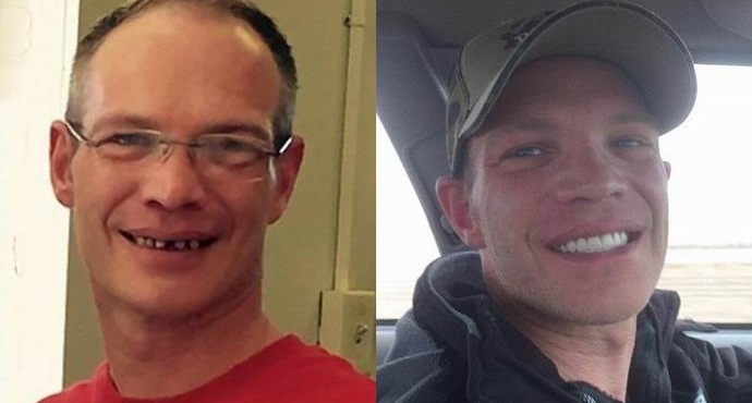 L'americano ha lasciato il cameriere venticinquemila per cure dentistiche