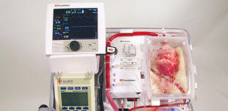 I medici australiani hanno imparato a trapiantare persone con cuori morti