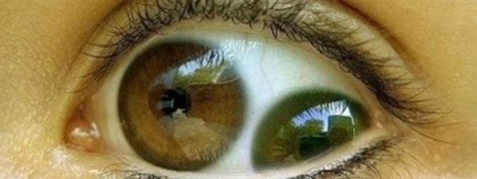 C'è una doppia pupilla?