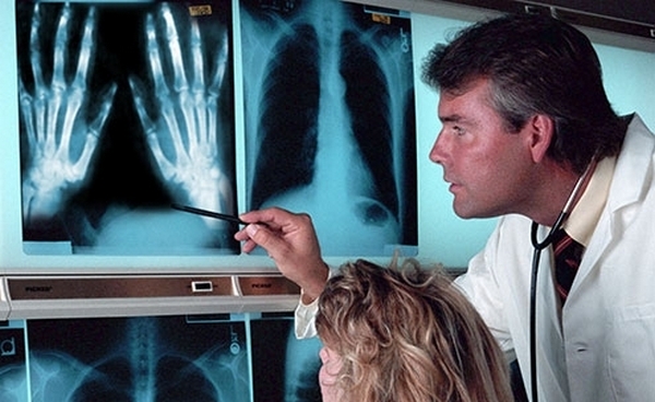 Dieci delle più strane malattie umane