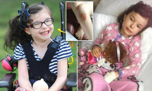 Una ragazza che non sente dolore