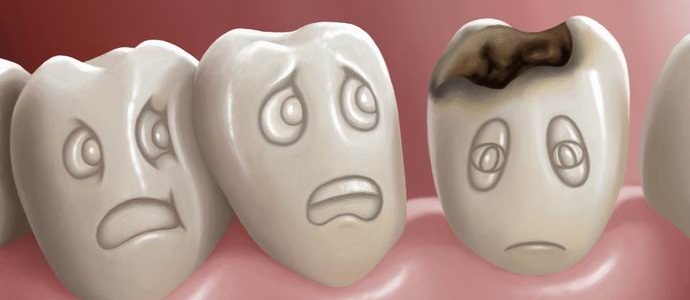 Due miliardi e mezzo di terrestri non vogliono curare la carie