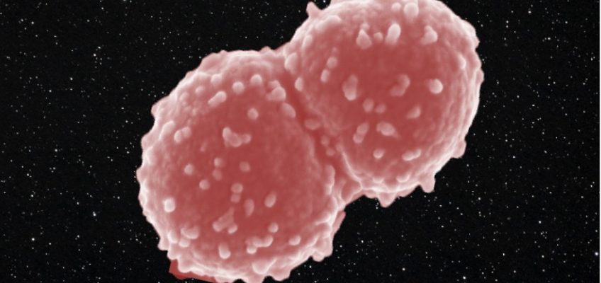 Questo batterio ha vissuto fuori dalla stazione spaziale per un anno intero. 