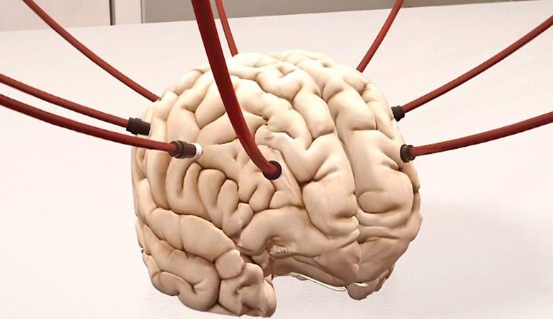 Il dibattito etico si è acceso dopo che gli scienziati hanno sostenuto la vita nel cervello di maiali decapitati