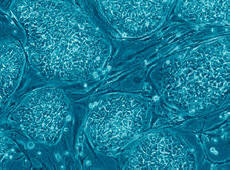 Gli scienziati olandesi si offrono di nutrire il mondo intero con carne di cellule staminali