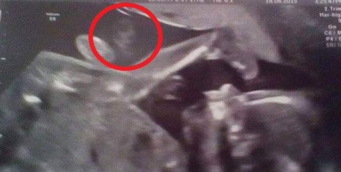 Un fantasma di una nonna apparve sull'immagine ecografica di un bambino