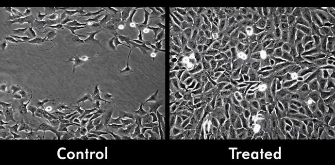 Le nanoparticelle accelereranno la guarigione della ferita della metà