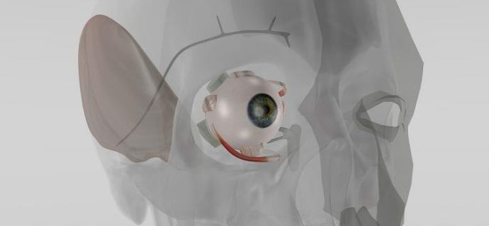 I tedeschi hanno inventato un impianto per regolare la pressione intraoculare