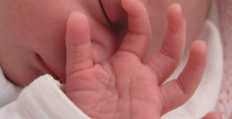 A proposito di una ragazza thailandese nata con una mascotte in mano