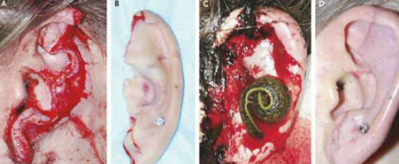 Le sanguisughe hanno aiutato i chirurghi a ripristinare l'orecchio di un cane strappato