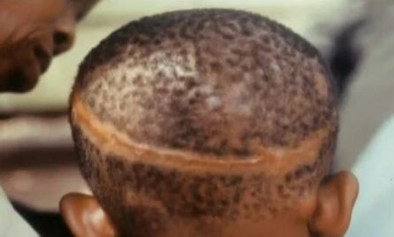 Le voglie sono legate alla morte violenta in una vita passata?