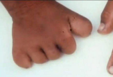 Le voglie sono legate alla morte violenta in una vita passata?