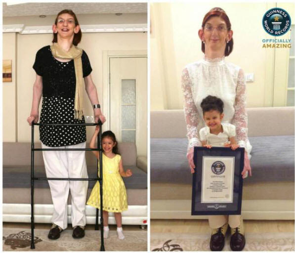 La ragazza più alta del mondo