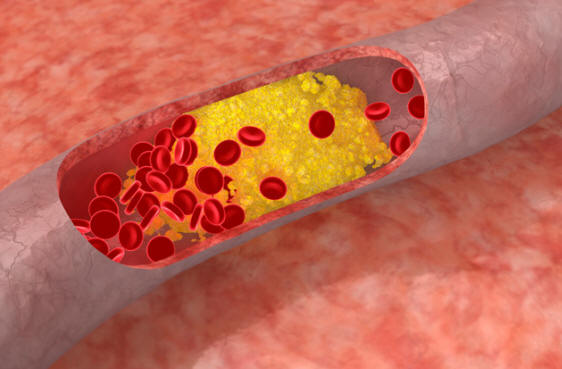 Abilità acquisite a seguito di rare mutazioni genetiche nell'uomo