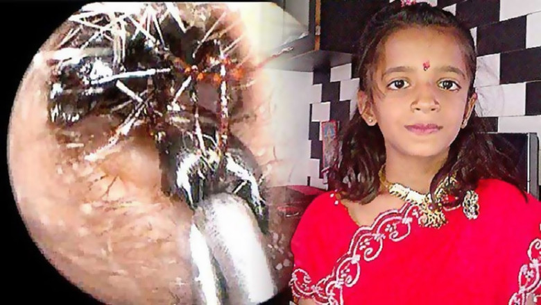 Strani casi medici con le formiche in India