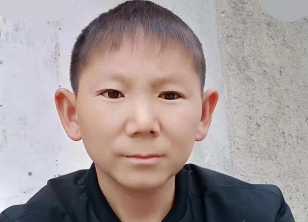 A 34 anni, un cinese sembra un bambino di 6 anni: dopo aver colpito la testa, un uomo ha smesso di crescere