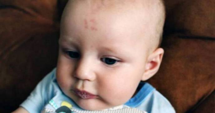 In Sudafrica, il ragazzo è contrassegnato da una voglia - il numero dodici