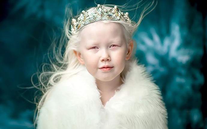 Yakut albino girl ha incantato Internet